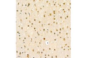 Immunohistochemistry (Paraffin-embedded Sections) (IHC (p)) image for anti-Homeobox C9 (HOXC9) antibody (ABIN7074251)