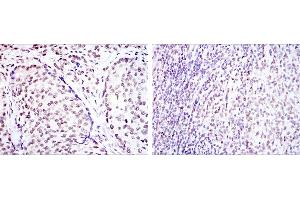 Immunohistochemistry (IHC) image for anti-cAMP Responsive Element Binding Protein 1 (CREB1) antibody (ABIN969061)