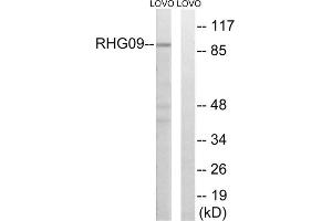 Western blot analysis of extracts from LOVO cells, using RHG9 antibody. (ARHGAP9 Antikörper  (Internal Region))