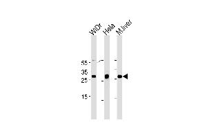 CDX1 Antibody (C-term) (ABIN1882223 and ABIN2843353) western blot analysis in WiDr,Hela cell line and mouse liver tissue lysates (35 μg/lane).
