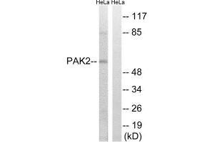 Western Blotting (WB) image for anti-P21-Activated Kinase 2 (PAK2) (Ser141) antibody (ABIN1848251) (PAK2 Antikörper  (Ser141))