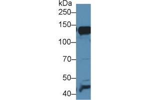 Western blot analysis of Mouse Liver lysate, using Mouse AAP Antibody (1 µg/ml) and HRP-conjugated Goat Anti-Rabbit antibody ( (ALT Antikörper  (AA 720-961))