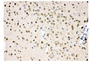 IHC analysis of VCP using anti-VCP antibody (ABIN3043958).