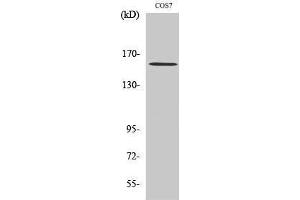 Western Blotting (WB) image for anti-rho-Associated, Coiled-Coil Containing Protein Kinase 1 (ROCK1) (Internal Region) antibody (ABIN3180302) (ROCK1 Antikörper  (Internal Region))