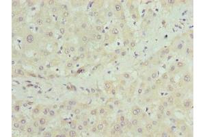 Immunohistochemistry of paraffin-embedded human liver tissue using ABIN7149063 at dilution of 1:100 (CRISPLD1 Antikörper  (AA 24-300))