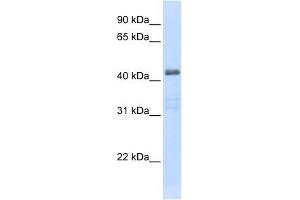 SLC29A2 antibody used at 1 ug/ml to detect target protein.