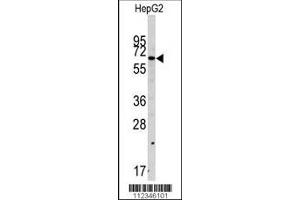 Western blot analysis of anti-SWAP70 Antibody in HepG2 cell line lysates (35ug/lane). (SWAP70 Antikörper  (AA 227-256))