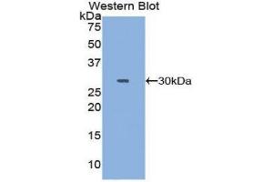 Western Blotting (WB) image for anti-DNA Topoisomerase II (TOP2) (AA 923-1148) antibody (ABIN1860829) (TOP2 Antikörper  (AA 923-1148))