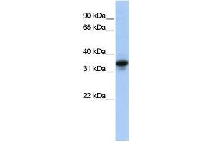 MUC3B antibody used at 1 ug/ml to detect target protein. (MUC3B Antikörper  (N-Term))