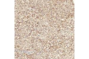 Immunohistochemistry (IHC) image for anti-Transforming Growth Factor, beta Receptor 1 (TGFBR1) (pSer165) antibody (ABIN7193143)