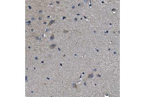 IHC analysis of ADRA1A using anti-ADRA1A antibody (ABIN3043732). (alpha 1 Adrenergic Receptor Antikörper  (C-Term))