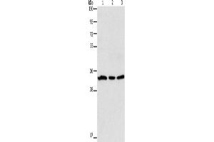 Western Blotting (WB) image for anti-Glycoprotein A33 (Transmembrane) (GPA33) antibody (ABIN2428183) (GPA33 Antikörper)