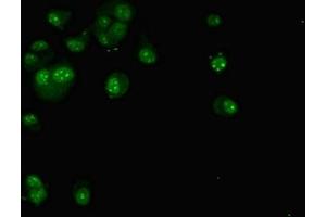 Immunofluorescent analysis of MCF-7 cells using ABIN7171562 at dilution of 1:100 and Alexa Fluor 488-congugated AffiniPure Goat Anti-Rabbit IgG(H+L) (TAF1C Antikörper  (AA 70-320))