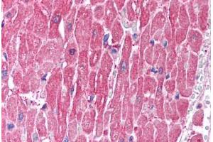 Human Heart (formalin-fixed, paraffin-embedded) stained with CLIC5 antibody ABIN214746 at 2. (CLIC5 Antikörper  (C-Term))