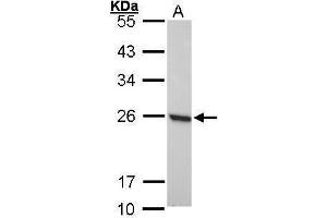 WB Image Sample (30 ug of whole cell lysate) A: 293T 12% SDS PAGE antibody diluted at 1:1000 (Peroxiredoxin 1 Antikörper)