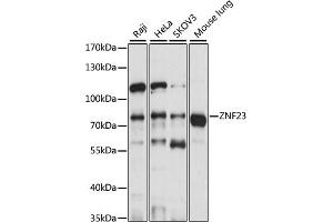 Western blot analysis of extracts of various cell lines, using ZNF23 antibody (ABIN7271469) at 1:1000 dilution. (ZNF23 Antikörper  (AA 1-220))