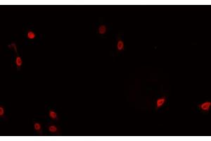 Immunofluorescence (fixed cells) (IF/ICC) image for anti-Tumor Necrosis Factor, alpha-Induced Protein 8 (TNFAIP8) (Internal Region) antibody (ABIN6265541)