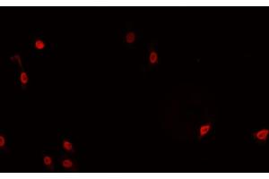 ABIN6266766 staining HeLa cells by IF/ICC. (TNFAIP8 Antikörper  (Internal Region))