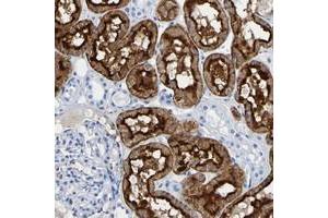 Immunohistochemical staining of human kidney with DPEP1 polyclonal antibody  shows strong cytoplasmic and membranous positivity in cells in tubules. (DPEP1 Antikörper)