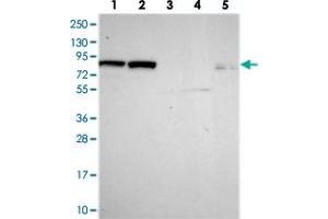 Western blot analysis of Lane 1: RT-4, Lane 2: U-251 MG, Lane 3: Human Plasma, Lane 4: Liver, Lane 5: Tonsil with DHX40 polyclonal antibody  at 1:250-1:500 dilution. (DEAH (Asp-Glu-Ala-His) Box Polypeptide 40 (DHX40) Antikörper)