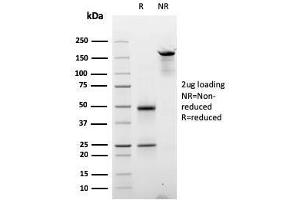 SDS-PAGE Analysis Purified Cyclin D2 Mouse Monoclonal Antibody (CCND2/2620). (Cyclin D2 Antikörper)