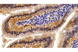 Detection of ALT in Mouse Small intestine Tissue using Polyclonal Antibody to Alanine Aminotransferase (ALT) (ALT Antikörper  (AA 143-417))
