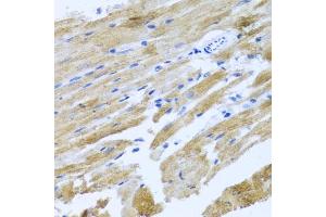 Immunohistochemistry of paraffin-embedded rat heart using MOK antibody (ABIN3022550, ABIN3022551, ABIN3022552 and ABIN6218895) at dilution of 1:100 (40x lens). (MOK Antikörper  (AA 1-230))