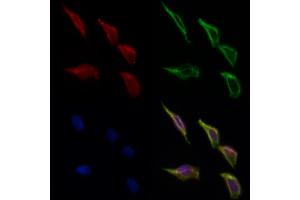 ABIN6266307 and ABIN6277426 staining Hela cells by IF/ICC. (PIBF1 Antikörper  (C-Term))