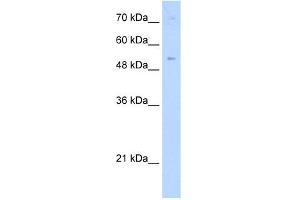 WB Suggested Anti-ZNF239 Antibody Titration:  0. (ZNF239 Antikörper  (Middle Region))