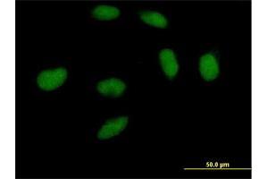 Immunofluorescence of purified MaxPab antibody to DNMT3A on HeLa cell. (DNMT3A Antikörper  (AA 1-912))