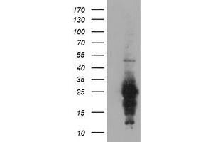 Western Blotting (WB) image for anti-Regulator of G-Protein Signaling 16 (RGS16) antibody (ABIN1500690) (RGS16 Antikörper)