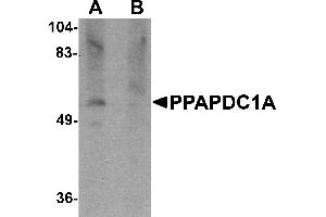 Western blot analysis of PPAPDC1A in human brain tissue lysate with PPAPDC1A antibody at 1 µg/mL in (A) the absence and (B) the presence of blocking peptide. (PPAPDC1A Antikörper  (C-Term))