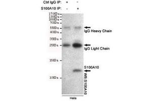 Immunoprecipitation of S100A10 from HeLa cell lysate, and subsequent western blot testing, using S100A10 antibody. (S100A10 Antikörper)