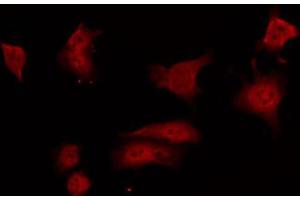ABIN6267693 staining 293 by IF/ICC. (GRLF1 Antikörper  (pTyr1105))