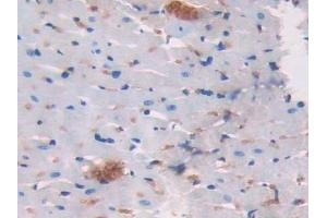 Detection of LCNL1 in Rat Heart Tissue using Polyclonal Antibody to Lipocalin Like Protein 1 (LCNL1) (LCNL1 Antikörper)