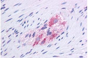 Human Colon, Myenteric Plexus: Formalin-Fixed, Paraffin-Embedded (FFPE) (GLUD1 Antikörper  (AA 182-231))