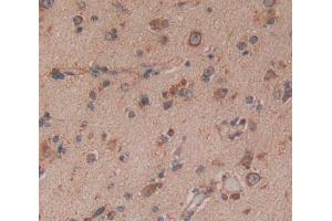 Used in DAB staining on fromalin fixed paraffin- embedded Kidney tissue (NTRK3 Antikörper  (AA 32-429))