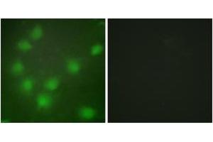 Immunofluorescence analysis of HuvEc cells, using HOXA11/D11 Antibody. (HOXA11/D11 Antikörper  (AA 216-265))