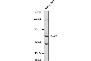 Western blot analysis of extracts of Mouse liver, using WASP Rabbit mAb (ABIN7271381) at 1:1000 dilution. (WASP Antikörper)