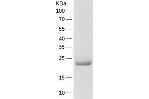 NFU1 Protein (AA 10-254) (His tag)