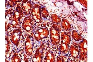 Immunohistochemistry of paraffin-embedded human small intestine tissue using ABIN7164219 at dilution of 1:100 (PFDN5 Antikörper  (AA 2-154))