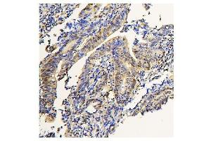 IHC analysis of ADK using anti-ADK antibody (ABIN7600222).