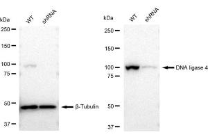 Western blotting analysis using DNA ligase 4 antibody (ABIN7799266). (Rekombinanter LIG4 Antikörper)