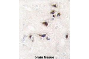Immunohistochemistry (IHC) image for anti-Calcium/calmodulin-Dependent Protein Kinase II alpha (CAMK2A) antibody (ABIN3003046) (CAMK2A Antikörper)