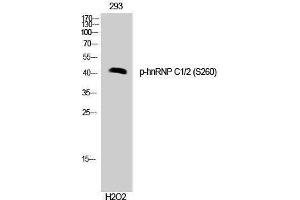 Western Blotting (WB) image for anti-Heterogeneous Nuclear Ribonucleoprotein C (C1/C2) (HNRNPC) (pSer260) antibody (ABIN3182632) (HNRNPC Antikörper  (pSer260))