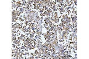 IHC analysis of MIM/MTSS1 using anti-MIM/MTSS1 antibody (ABIN7600276).