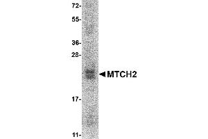 Western Blotting (WB) image for Mitochondrial Carrier 2 (MTCH2) (AA 29-174) protein (His tag) (ABIN2468870)