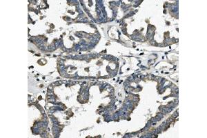 IHC analysis of FIS1 using anti-FIS1 antibody (ABIN7598965). (Fission 1 Antikörper  (AA 1-121))