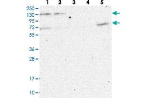 Western blot analysis of Lane 1: RT-4, Lane 2: U-251 MG, Lane 3: Human Plasma, Lane 4: Liver, Lane 5: Tonsil with MATR3 polyclonal antibody . (MATR3 Antikörper)