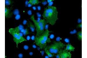 Anti-CCM2 mouse monoclonal antibody (ABIN2454979) immunofluorescent staining of COS7 cells transiently transfected by pCMV6-ENTRY CCM2 (RC201418). (CCM2 Antikörper)